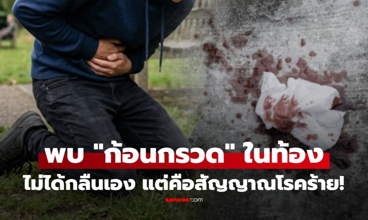 เด็ก 15 อ้วกเลือด! ท้องแน่นก้อนกรวด ไม่ใช่กลืนเอง แต่ เชื้อร้าย กำลังลุกลามมะเร็งกระเพาะ?!