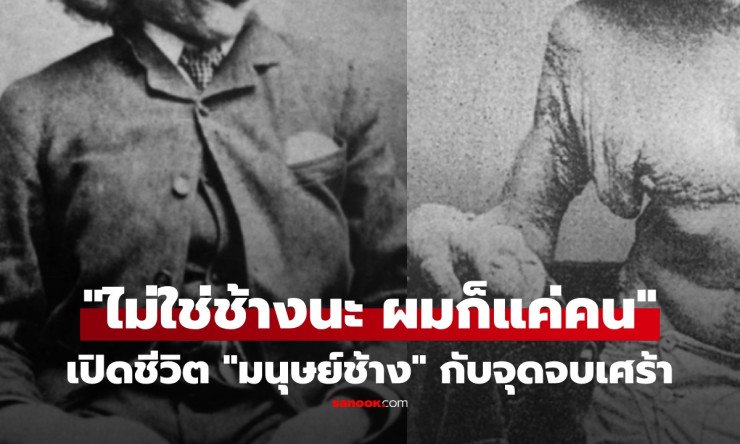 ช็อกทั้งโลก! ชีวิตมนุษย์ช้างสุดสะเทือนใจ ถูกตราหน้าว่า สัตว์ประหลาด แต่จิตใจดีกว่าคนปกติซะอีก!