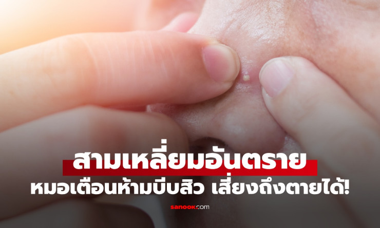 ตำแหน่งสามเหลี่ยมอันตรายบนใบหน้า ห้ามบีบสิวเด็ดขาด เสี่ยงถึงตายได้!