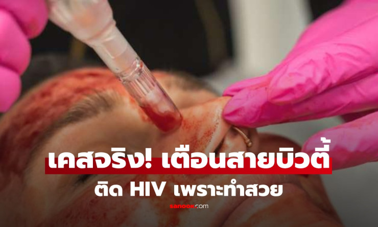 ช็อกสุดขีด! สาวๆ 3 คนติด HIV จากทำหน้า Vampire Facial คลินิกเถื่อน เสี่ยงตายทั้งสวย!