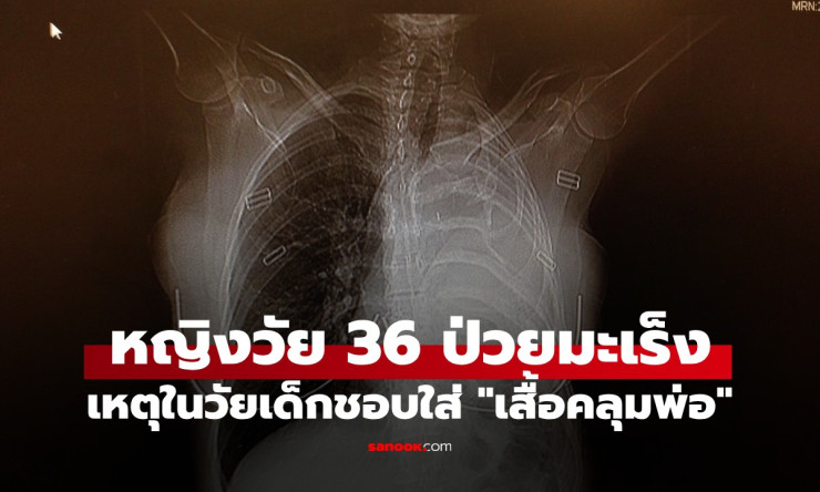ช็อกสุดขีด! สาว 36 ชีวิตเหลือแค่ 15 เดือน แค่เพราะเด็กๆ ชอบยืม เสื้อคลุมพ่อ ใส่?? เรื่องจริงที่คุณต้