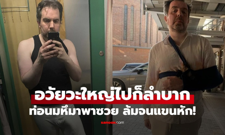 เปิดชีวิตชายเจ้าของสถิติ อาวุธลับใหญ่ที่สุดในโลก ท่อนมหึมาพาซวย ล้มจนแขนหัก!