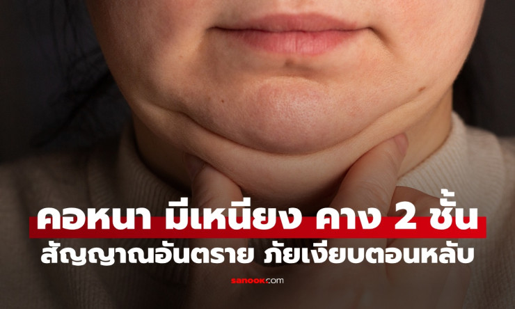 เหนียงคาง 2 ชั้น ไม่ใช่แค่เสียเซลฟี่! หมอเตือนภัยเงียบตอนหลับ รีบเช็กด่วนก่อนสายเกินแก้!
