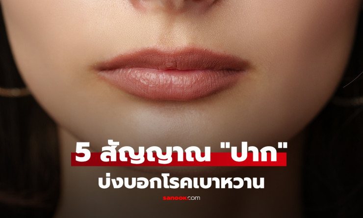 อย่ามองข้าม! เปิด 5 สัญญาณในช่องปาก อาจเตือนเสี่ยง “เบาหวาน” ข้อแรกพบได้ถึง 49%