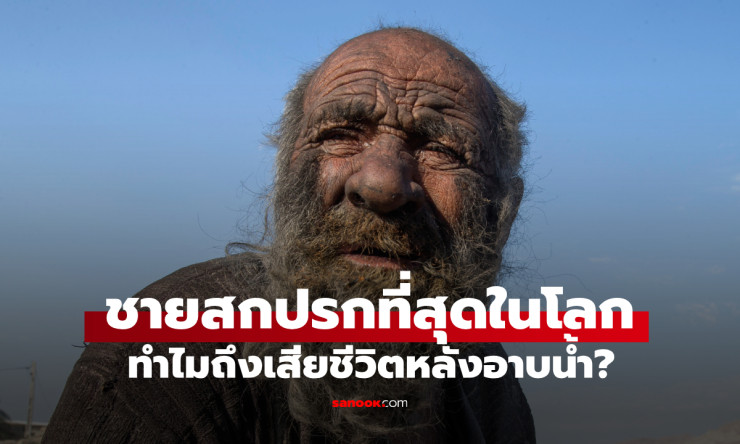 ไขข้อสงสัย ทำไมชายที่สกปรกที่สุดในโลก ถึงเสียชีวิตทันทีหลังอาบน้ำครั้งแรก