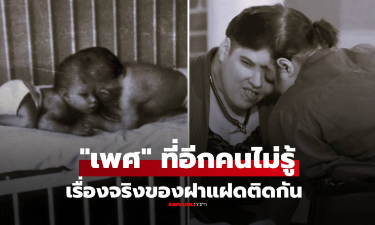 ช็อกโลก! ฝาแฝดติดกันซ่อนเพศลับไว้หลายสิบปี แม้อยู่ติดกันแต่ชีวิตแยกชัด เหมือนคนละคน!