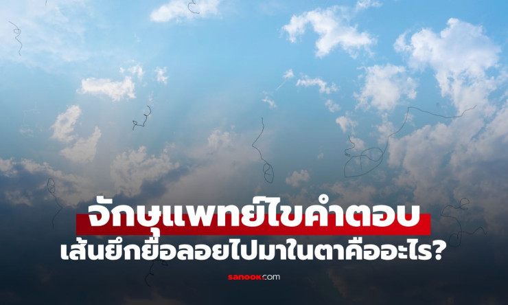 เส้นยึกยือลอยวนในตา! อย่าช้า รีบเช็กด่วน ก่อนสายเกินแก้ จักษุแพทย์เตือน!