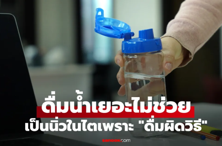 พนักงานออฟฟิศดื่มน้ำวันละ 2 ลิตร แต่ยังเป็นนิ่วในไต: หมอชี้จุดพลาด 4 ข้อ