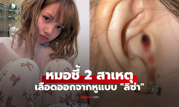 แพทย์เตือน 2 สาเหตุหลักเลือดไหลออกจากหูแบบลิซ่า พร้อมวิธีรับมือเมื่อเกิดอาการ